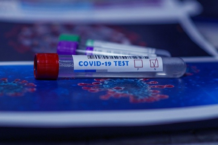 COVID-19 в Казахстане. Optimizm.kz