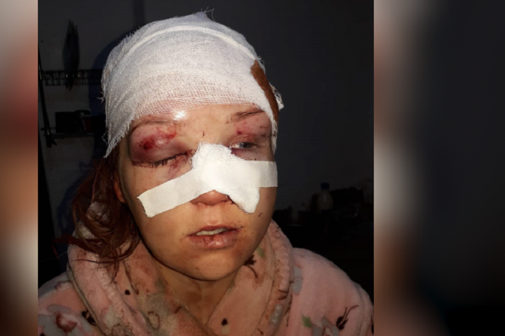 «Бил молотком». В Шымкенте мужчину подозревают в нападении на бывшую супругу