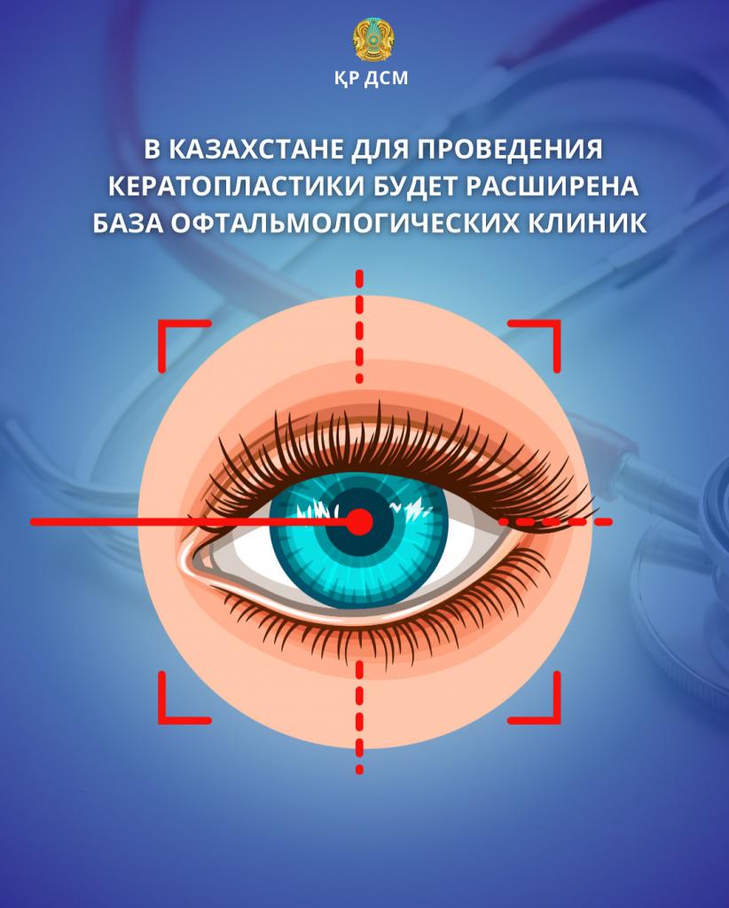 В КАЗАХСТАНЕ ДЛЯ ПРОВЕДЕНИЯ КЕРАТОПЛАСТИКИ БУДЕТ РАСШИРЕНА БАЗА ОФТАЛЬМОЛОГИЧЕСКИХ КЛИНИК